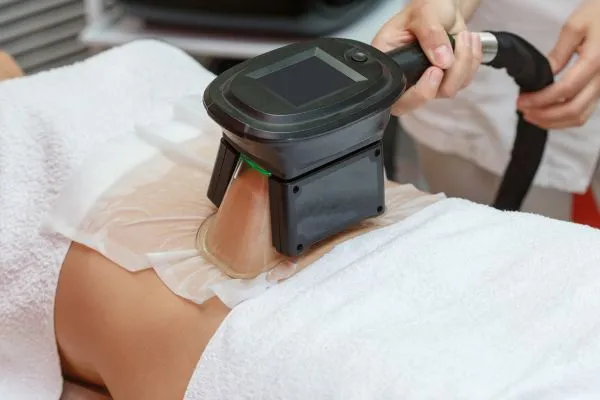 Image of person having fat freezing treatment to help weight gain Dorking