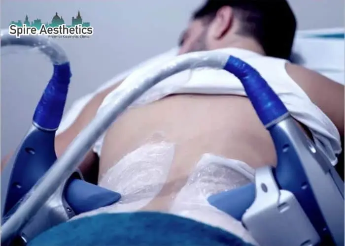 Man having fat freezing treatment done on love handles before a competitions Dorking to create a sculpted look.