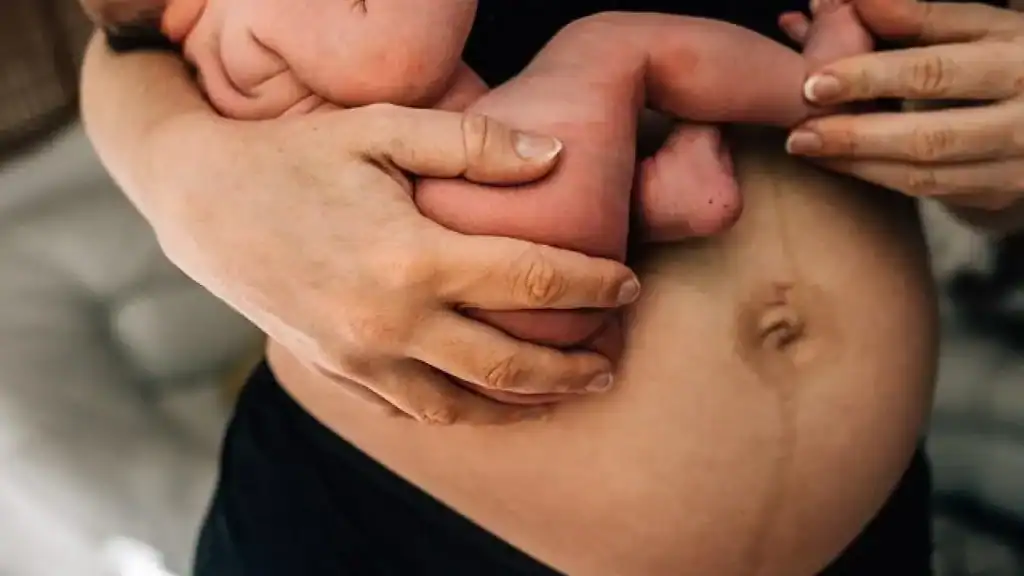 Why Is My Stomach Still Big After Pregnancy Dorking?